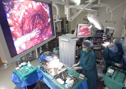 Al Hartmann  |  The Salt Lake Tribune
This robotic surgery team at Intermountain Medical Center in Murray uses high-definition monitors during a prostate procedure Friday.