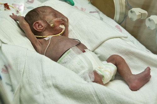 Chris Detrick  |  The Salt Lake Tribune
A baby receives Prolact+4 H2MF, a human milk fortifier, in the Neonatal Intensive Care Unit at the McKay-Dee Hospital Center in Ogden on Wednesday.