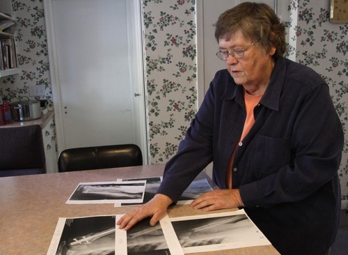 Rick Egan  | The Salt Lake Tribune 

Louise Degn, journalism professor at the U., looks at her X-rays. She has bone cancer but continues to conduct her LDS ward choir. Thursday, Dec. 22, 2011.
