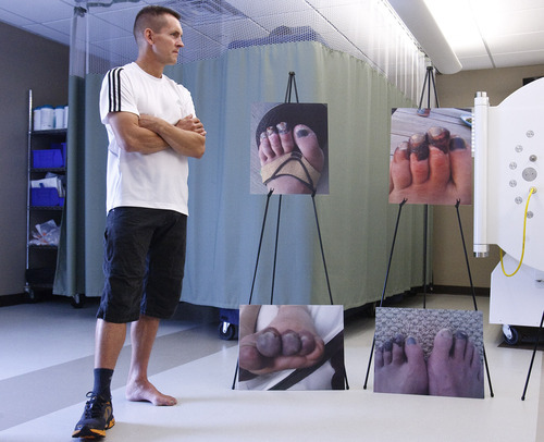 Leah Hogsten  |  The Salt Lake Tribune
William Calton stands next to several photographs of his formerly frostbitten left foot at Ogden Regional Medical Center's Wound Care and Hyperbaric Center. This past spring, Calton barely survived a deadly traffic jam on Mount Everest, stemming from weeks of bad weather that had created a bottleneck of climbers ascending and descending May 19.