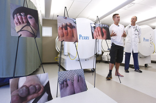 Leah Hogsten  |  The Salt Lake Tribune
William Calton, of Ogden, talks about his Mount Everest climb and the 15 days of treatment at Ogden Regional Medical Center's Wound Care and Hyperbaric Center. This past spring, Calton barely survived a deadly traffic jam on Mount Everest.