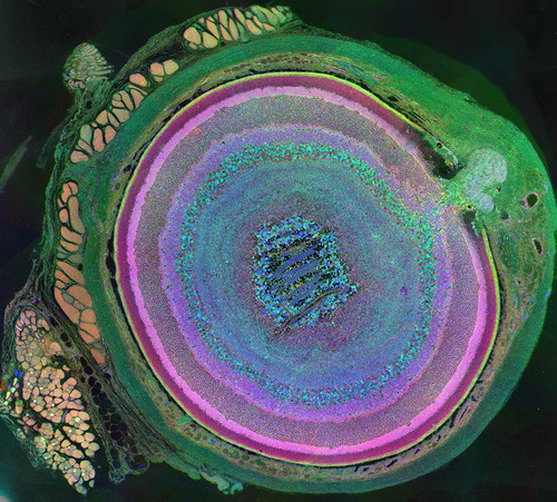 This image of a mouse's eye, created by University of Utah researchers, won best photograph in the International Science and Engineering Visualization Challenge, hosted annually by the American Association for the Advancement of Science. Titled 