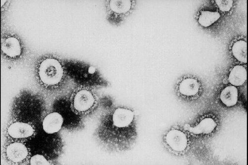 A new coronavirus that emerged in the Middle East last fall could be more deadly than SARS, researchers from the University of Hong Kong say. (CDC/Getty Images)