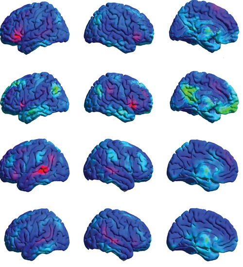 Image courtesy of Jeff Anderson, University of Utah
University of Utah scientists will study the effects of religion on returned missionaries'  brains using MRI scans like these, which show the portions of the brain that govern social behavior, such as charity and relationships.