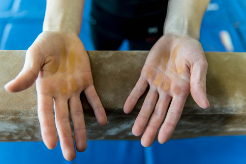 Trent Nelson  |  The Salt Lake Tribune
University of Utah gymnast Georgia Dabrtiz doesn't wear grips, resulting in large callouses on her hands. Thursday February 6, 2014 in Salt Lake City.