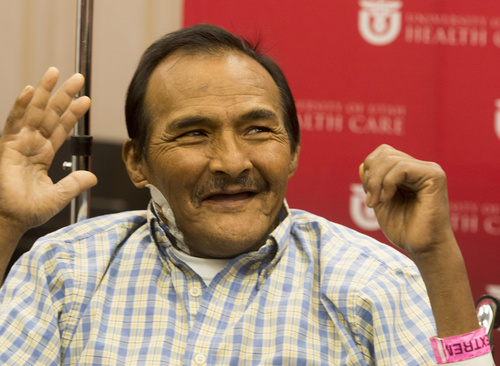 Rick Egan  |  The Salt Lake Tribune

Andres Galvan talks about his new kidney. Galvan is believed to be the first patient in Utah with hepatitis C who has received a kidney transplant using an organ from a donor with hepatitis C. Thursday, July 31, 2014