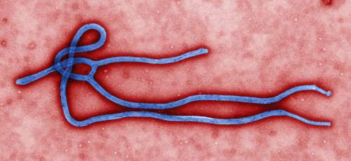 FILE - This undated file image made available by the Centers for Disease Control (CDC) shows the Ebola virus.  (AP Photo/Centers for Disease Control, File)