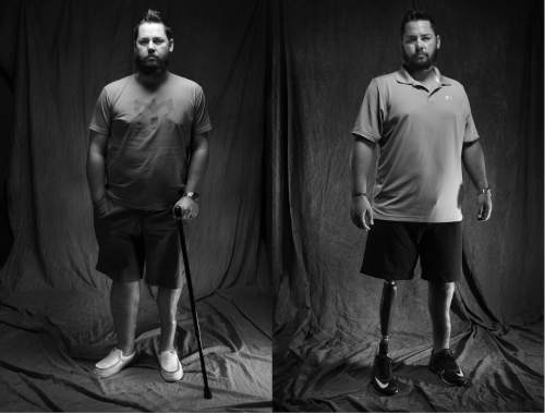 Scott Sommerdorf   |  The Salt Lake Tribune

Bryant Jacobs is seen in two different portraits shot in the Tribune's photo studio. On the left he is seen on Tuesday, Mar. 6, 2014, before he had his right leg amputated. On the right he is seen with his prosthetic leg on Thursday, July 31, 2014.