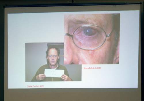 Al Hartmann  |  The Salt Lake Tribune
State exhibit of Johnny Brickman Wall's red eye shown in Third District Court in Salt Lake City Wednesday March 4.  Wall, a former Utah pediatrician, is accused of killing his ex-wife, Uta von Schwedler at her Sugar House home in 2011.