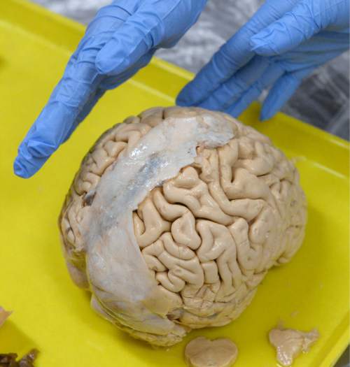 Al Hartmann  |  The Salt Lake Tribune
Fourth grade students  touch a donated human brain at Brain Awareness Week at Neil Armstrong Academy in West Valley City Tuesday March 15.  Brain Awareness Week is sponsored by the Interdepartmental Program in Neuroscience at the University of Utah.