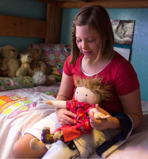 Rick Egan  |  The Salt Lake Tribune

Lydia Petrucka, 10, plays with her doll, Lillia, who also has a prosthetic leg.  Lydia will be attending the Amputee Coalition Paddy Rossbach Youth Camp in Clarksville, Ohio next week. Despite the loss of her left leg, she spending time with her dogs, riding her knee scooter and jumping on her trampoline. Saturday, July 2, 2016.