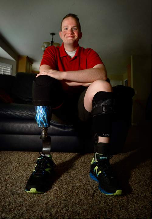 Scott Sommerdorf   |  The Salt Lake Tribune  
Ryan Bahr, a 21-year-old amputee from Murray, Utah has been chosen to serve as a counselor at the Amputee Coalition's Paddy Rossbach Youth Camp July 8-13 in Clarksville, Ohio. Bahr poses at his home in Murray, Saturday, July 2, 2016.