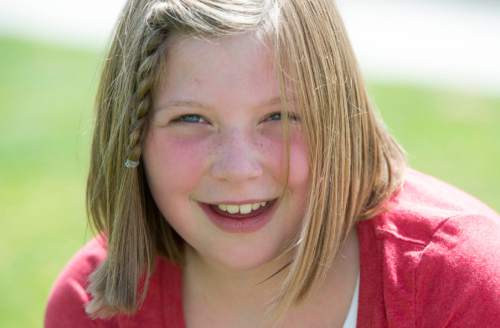 Rick Egan  |  The Salt Lake Tribune

Lydia Petrucka, 10, plays will be attending the Amputee Coalition Paddy Rossbach Youth Camp in Clarksville, Ohio next week. Despite the loss of her left leg, she spending time with her dogs, riding her knee scooter and jumping on her trampoline. Saturday, July 2, 2016.