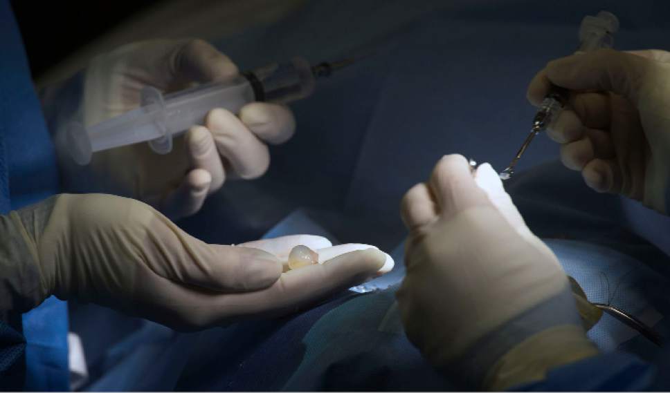 Steve Griffin / The Salt Lake Tribune


A surgical team member holds a cataract and lens, that was just removed from the right eye of zoo resident Nika, a 13-year-old harbor seal, at the care center at the Hogle Zoo in Salt Lake City Thursday December 1, 2016. Specialists from Florida joined a Hogle Zoo team as they removed cataracts during surgery. Keepers and vet staff have seen the cataracts in her eye. They began developing in one eye first and then the other. The animal eye surgeon and pinniped (seals and sea lions) anesthesiologist are in town from Florida to help because it is tricky to do anesthesia on pinnipeds because of their complicated breathing mechanism. The plan is to remove the cataracts and have Nika recover in a holding room that is part of her enclosure at the zoo. Nikki will need to stay out of the water for about three weeks to heal.