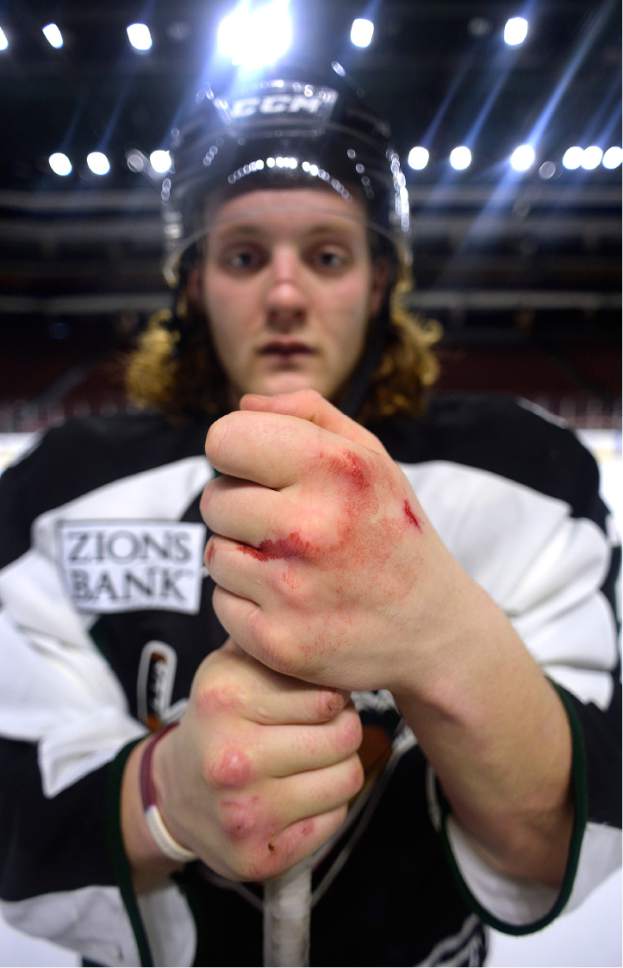 Scott Sommerdorf | The Salt Lake Tribune
Utah Grizzlies hockey player Travis Howe poses for a portrait with his knuckles bleeding after practice, Thursday, March 2, 2017.