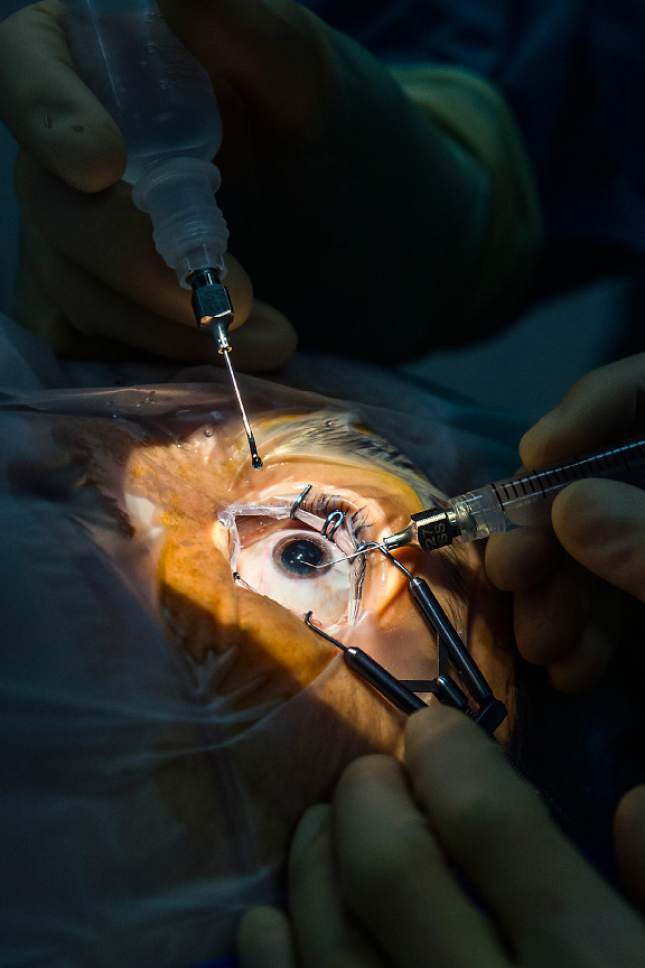 Chris Detrick  |  The Salt Lake Tribune
Dr. Craig Chaya and Dr. Eileen Hwang perform cataract surgery on Maria Salcedo, of Salt Lake City, at the Moran Eye Center Saturday, April 8, 2017.  John A. Moran Eye Center surgeons provided free, sight-restoring surgeries for twenty-three cataract patients as part of Operation Sight Day, a twice-yearly event assisting low-income, uninsured Utahns in need of care.