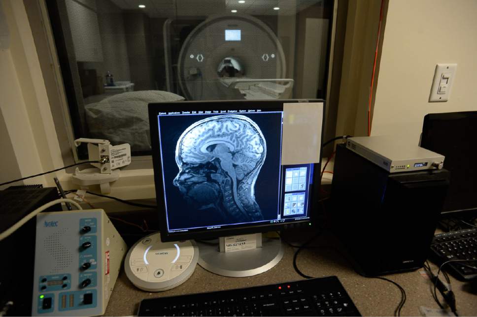 Francisco Kjolseth | The Salt Lake Tribune
Bryce Hortin, 11, of Syracuse is positioned in the machine that will periodically capture images of his brain over a 10-year study. At the U of U, psychology professor Deborah Yurgelun-Todd aims to enroll 1,000 Utahns into a study that will ultimately include 12,000 across the country to monitor kids in their preteen and teen years.