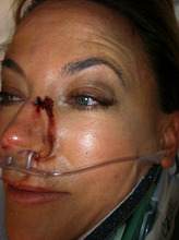 Fox 13 anchor to return full-time Monday after bicycle accident - The